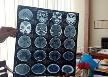 Felica Khunlisa Diduga Jadi Korban Malpraktek Saat Dirawat di RSUD Rader Mattaher Jambi