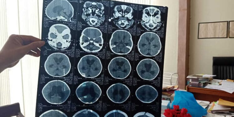 Felica Khunlisa Diduga Jadi Korban Malpraktek Saat Dirawat di RSUD Rader Mattaher Jambi