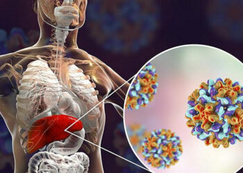 Penyakit Hepatitis ‘Misterius’ Asal Inggris Serang Anak-anak Indonesia, 3 Dilaporkan Meninggal Dunua