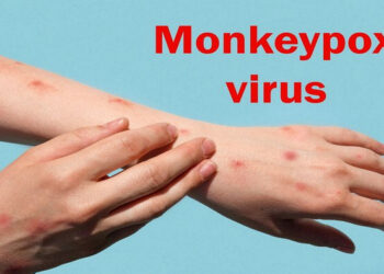 Waspada! Indonesia Temukan Kasus Cacar Monyet Pertama