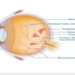 Mewaspadai Pasien Diabetik Makular yang Berisiko Kebutaan