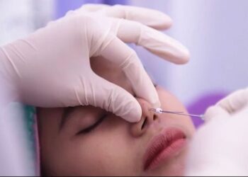 Botox dan Filler Jadi Tren Perawatan Kecantikan Tahun Ini