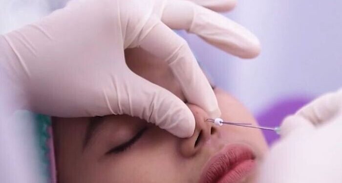 Botox dan Filler Jadi Tren Perawatan Kecantikan Tahun Ini