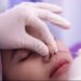 Botox dan Filler Jadi Tren Perawatan Kecantikan Tahun Ini