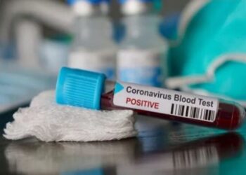 Pakar Sarankan Masyarakat Pakai Masker Demi Cegah Terkena Kraken