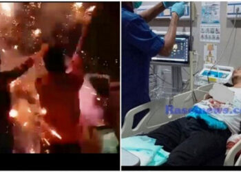 Nah, Lho! Akibat Main Petasan Saat Rayakan Pergantian Tahun, Jari Wakil Bupati Kaur, Bengkulu Putus