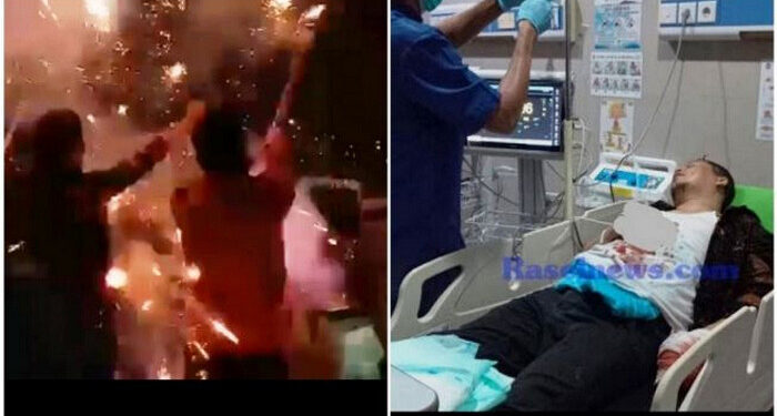 Nah, Lho! Akibat Main Petasan Saat Rayakan Pergantian Tahun, Jari Wakil Bupati Kaur, Bengkulu Putus