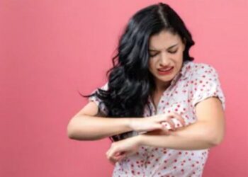 Buruknya Kebersihan Diri dan Keringat Berlebih Sebabkan Infeksi Jamur