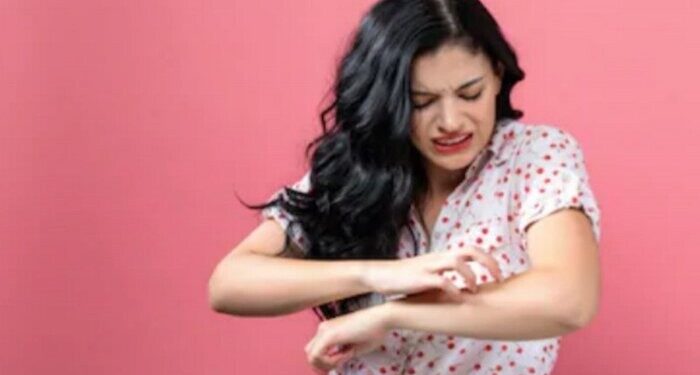 Buruknya Kebersihan Diri dan Keringat Berlebih Sebabkan Infeksi Jamur