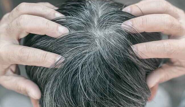 Makanan Penyebab Uban Tumbuh Lebih Cepat: Apa Saja yang Harus Dihindari?